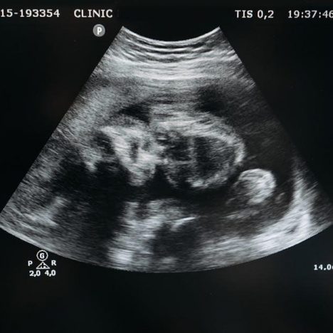 manitowoc ice machine manual pdf